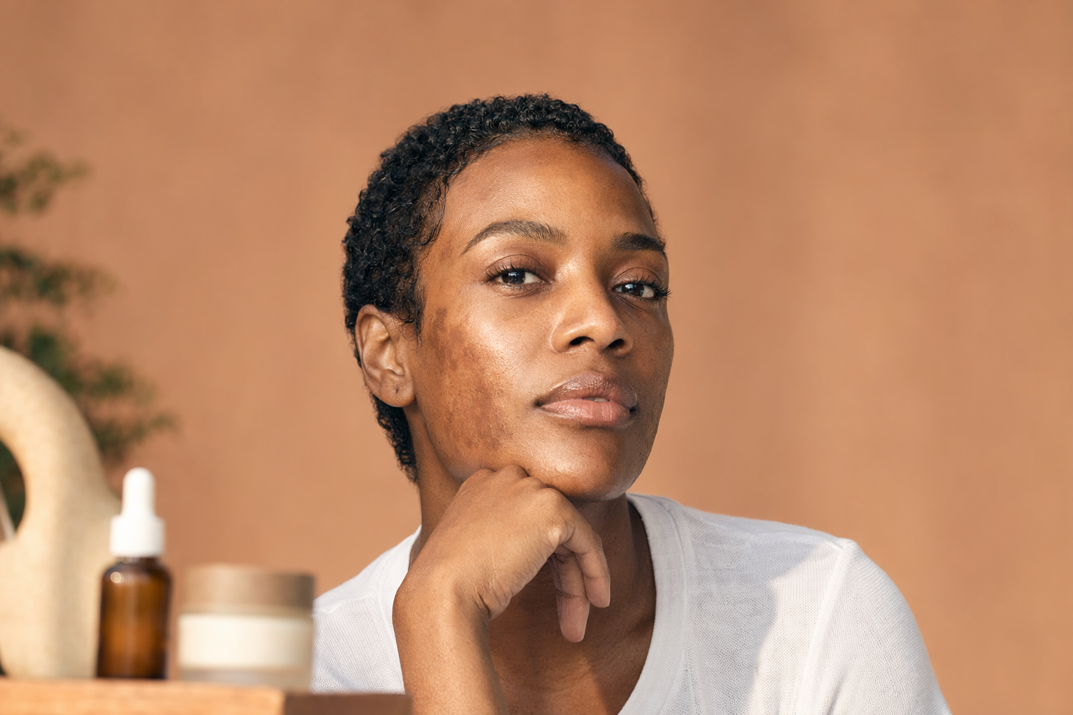 Hyperpigmentation : pourquoi la niacinamide ne suffit pas